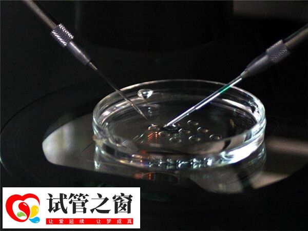 高齡適合做第三代試管嬰兒