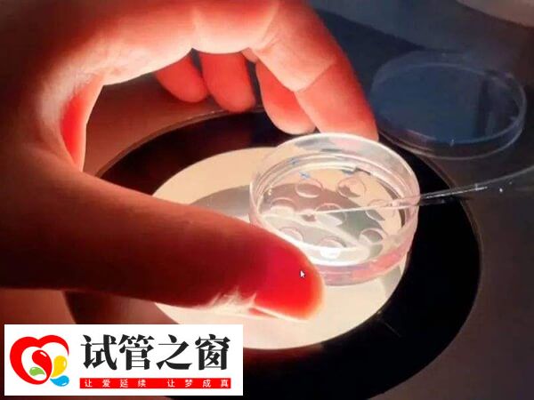 胚胎移植后不要一直臥床