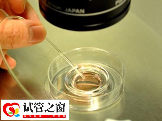 試管受精卵需培養(yǎng)3到5天成為胚胎