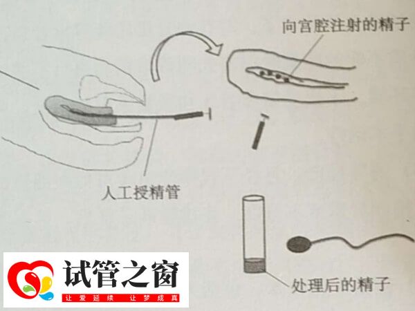 人工授精成功率不高